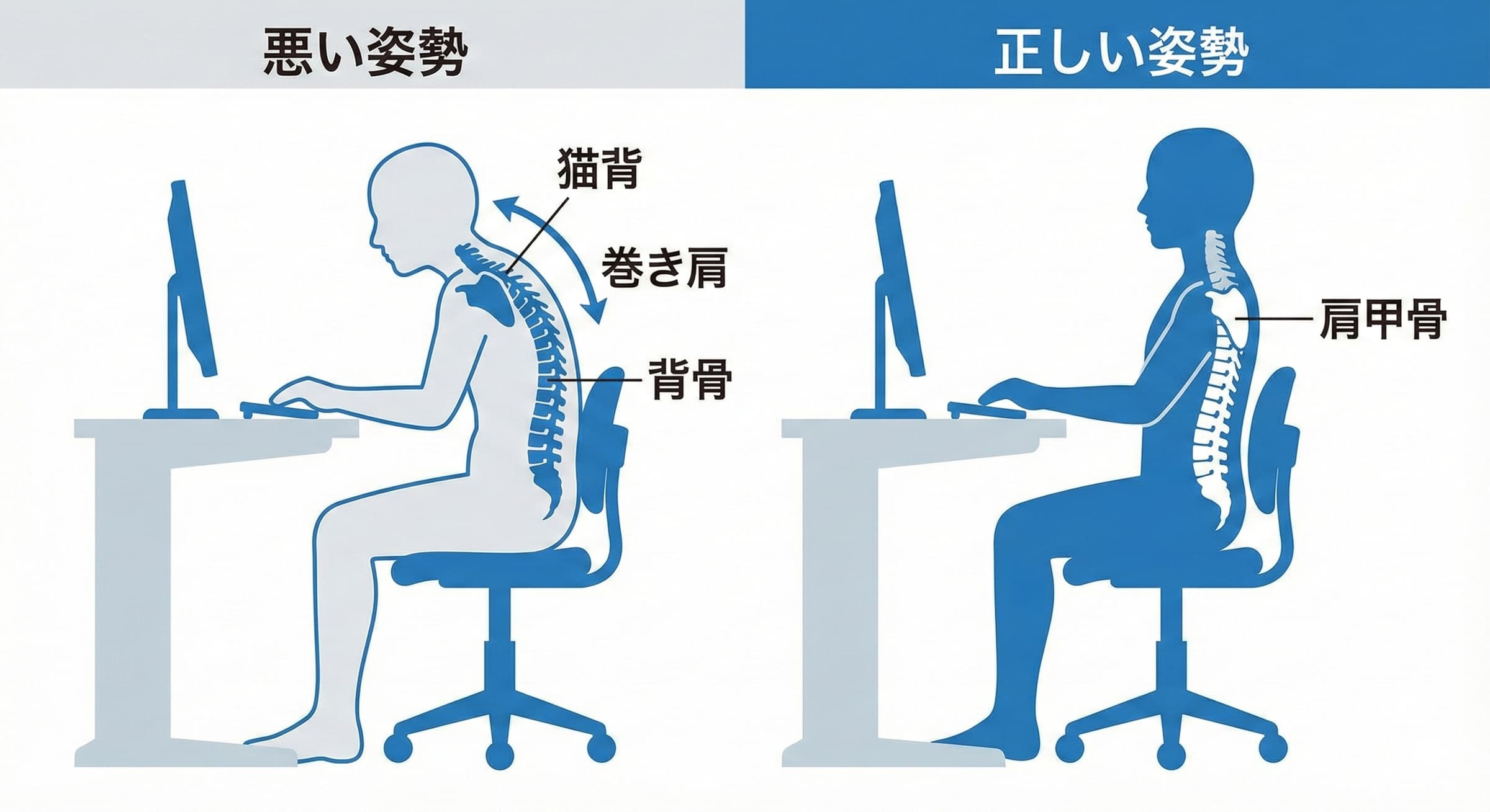 猫背姿勢のイラスト