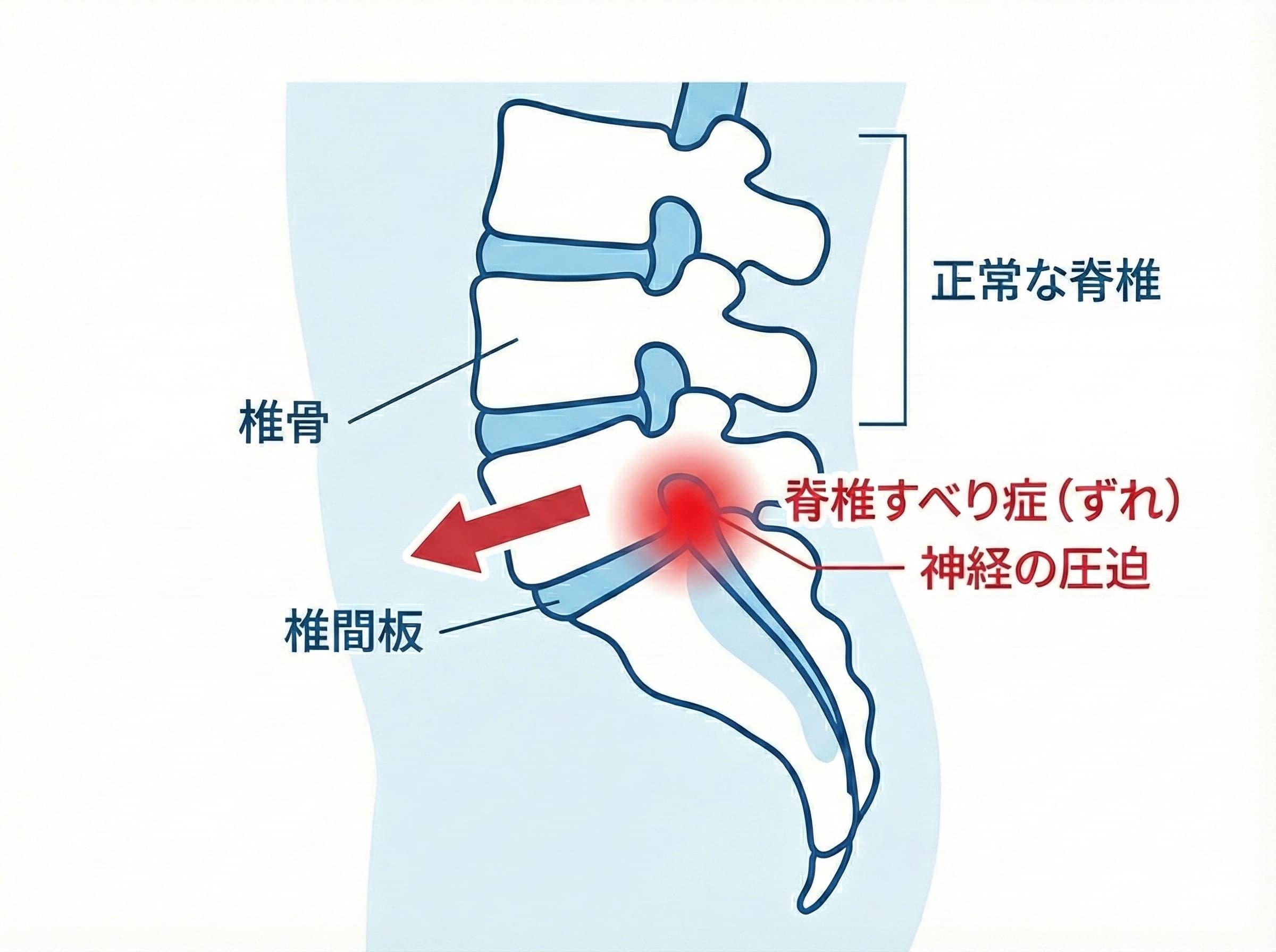 脊椎のイメージ図