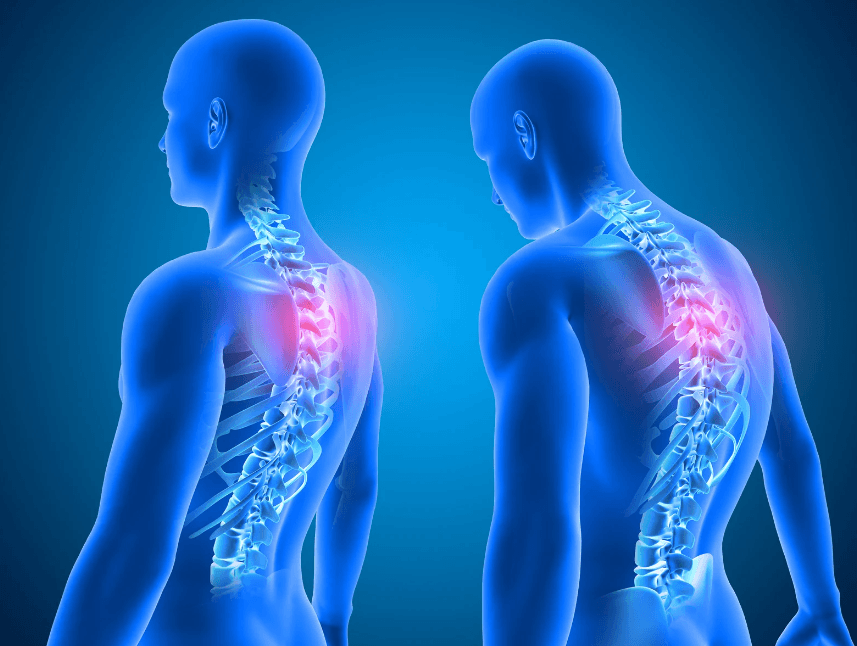 姿勢が悪い人と背骨のイメージ