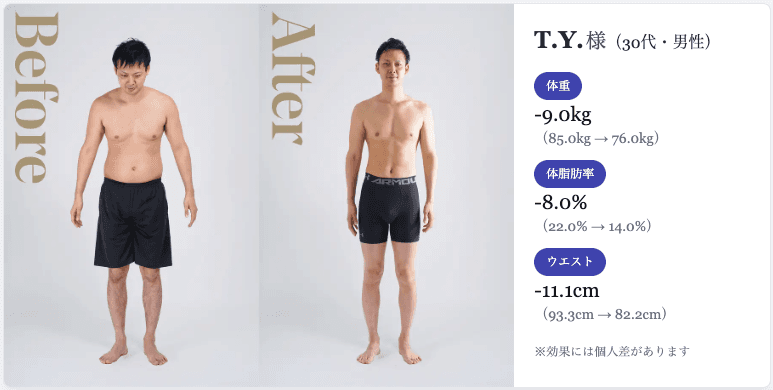 T.Y.様 30代 男性(3ヶ月ビフォーアフター)