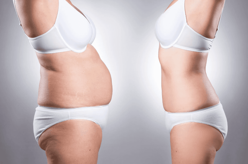 ダイエットのビフォーアフターのイメージ