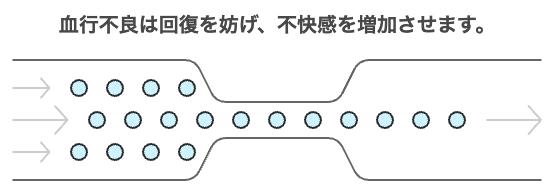 解説図：血行不良は回復を妨げ、不快感を増加させます