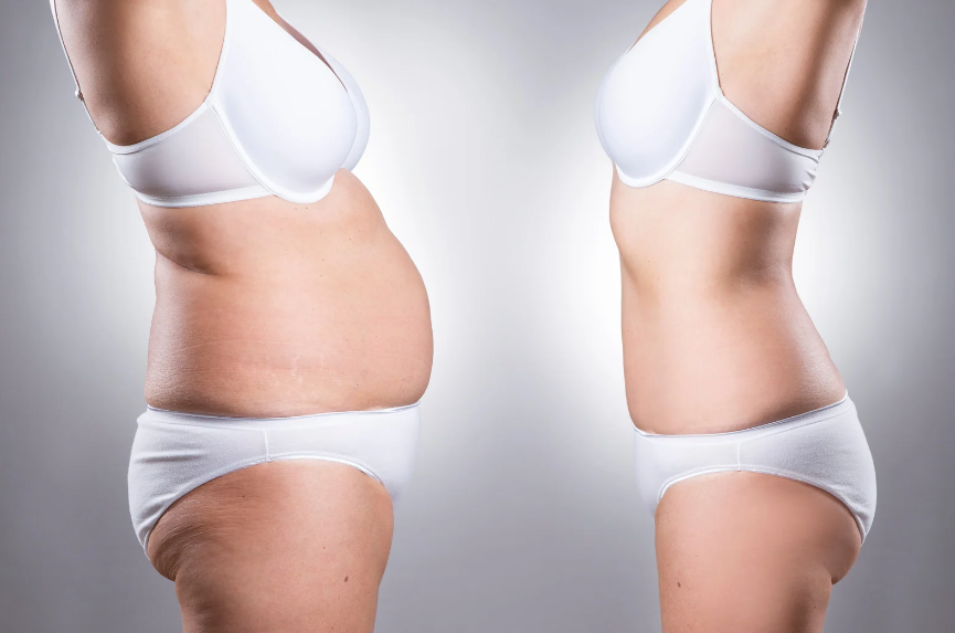 ダイエットのビフォーアフターのイメージ