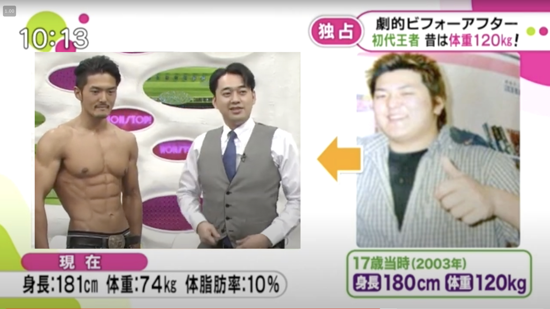 17歳当時、体重120kgだった頃の青木泰蔵（TV出演時のビフォーアフター）
