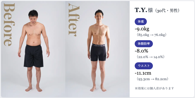 T.Y.様 30代 男性(3ヶ月ビフォーアフター)